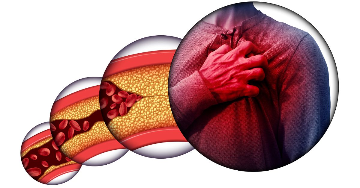 Enfermedades Cardíacas